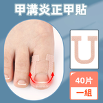 【上手家居】甲溝炎正甲貼 40貼組-40片組(凍甲/嵌甲/卷甲/嵌甲貼片/腳趾甲貼片), , large