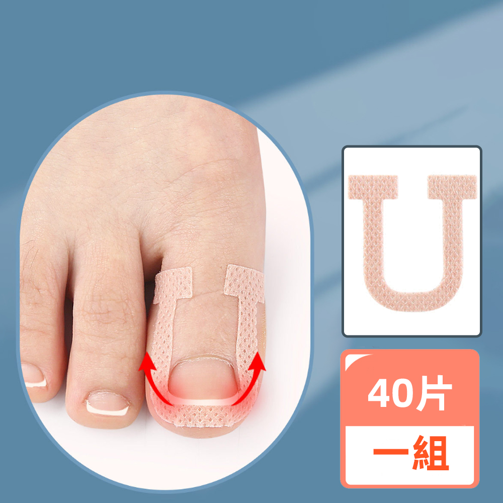 【上手家居】甲溝炎正甲貼 40貼組-40片組(凍甲/嵌甲/卷甲/嵌甲貼片/腳趾甲貼片), , large
