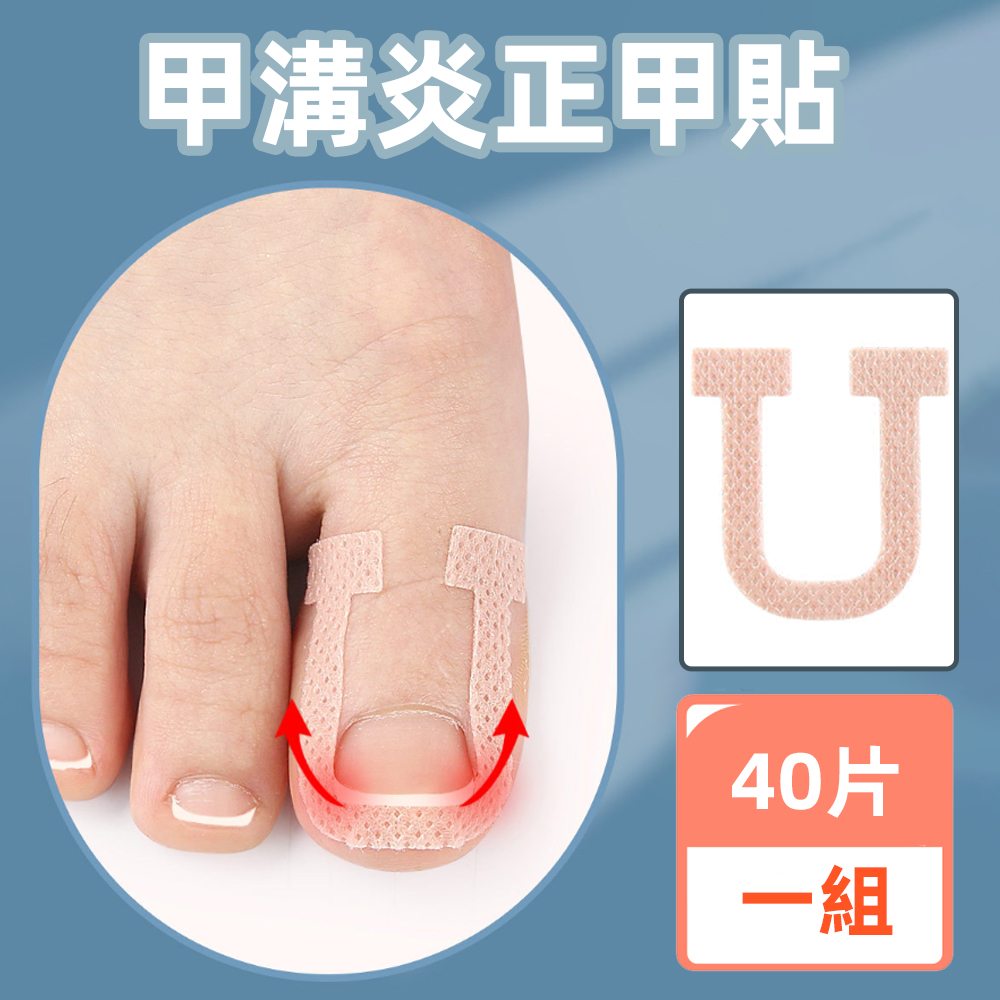 【上手家居】甲溝炎正甲貼 40貼組-40片組(凍甲/嵌甲/卷甲/嵌甲貼片/腳趾甲貼片), , large