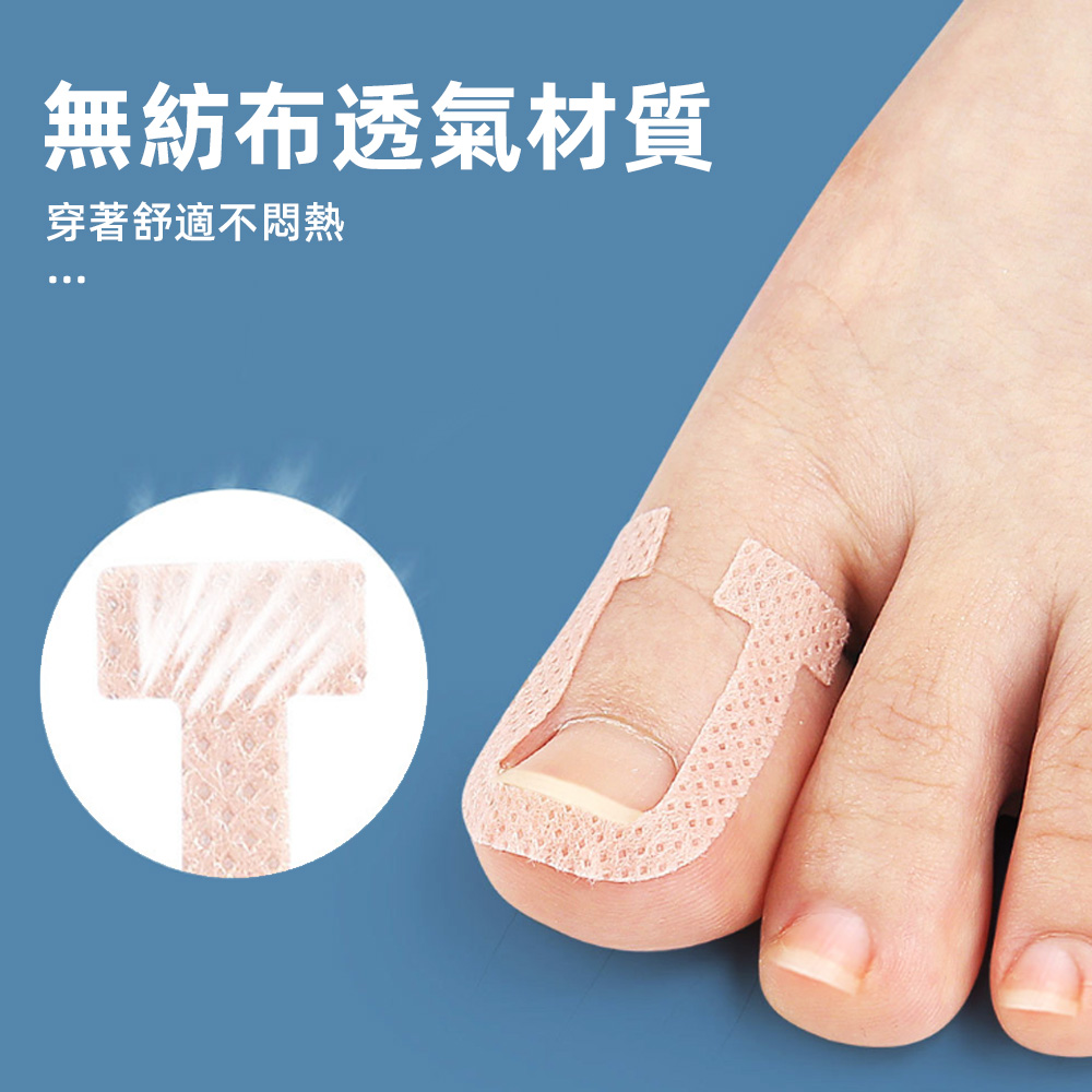 【上手家居】甲溝炎正甲貼 40貼組-40片組(凍甲/嵌甲/卷甲/嵌甲貼片/腳趾甲貼片), , large
