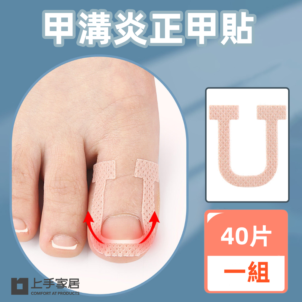 【上手家居】甲溝炎正甲貼 40貼組-40片組(凍甲/嵌甲/卷甲/嵌甲貼片/腳趾甲貼片), , large