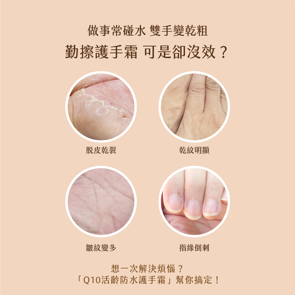 KOSE Q10 Live Age Official Direct Revitalizing Waterproof Hand Cream EX80g | Buy Qili, , large