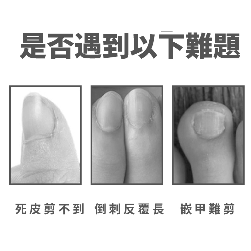 Toenail Clippers for Thick Toenails, Slanted Nail Clippers for Men Thick Ingrown Nails with Wide Jaw Opening, Heavy Duty Curved Large Fingernail Ingrown Toenail Clippers, SUNDEN SD1440, , large
